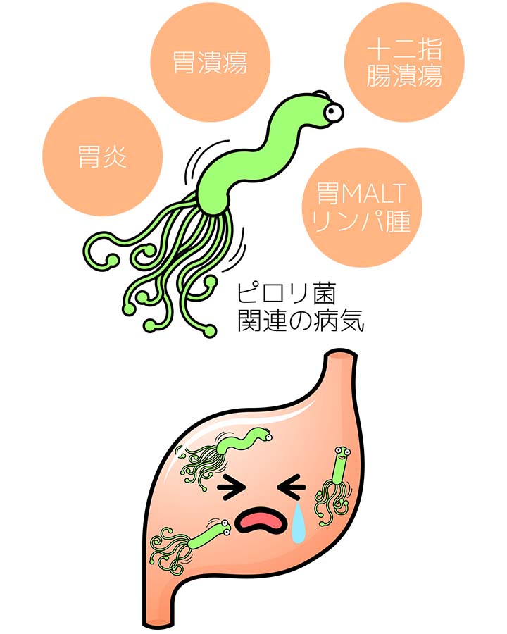 ヘリコバクターピロリ感染症
