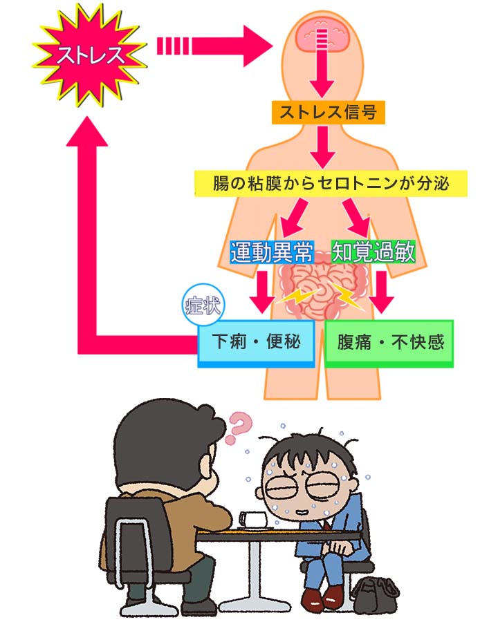 過敏性腸症候群(IBS;irritable bowel syndrome)