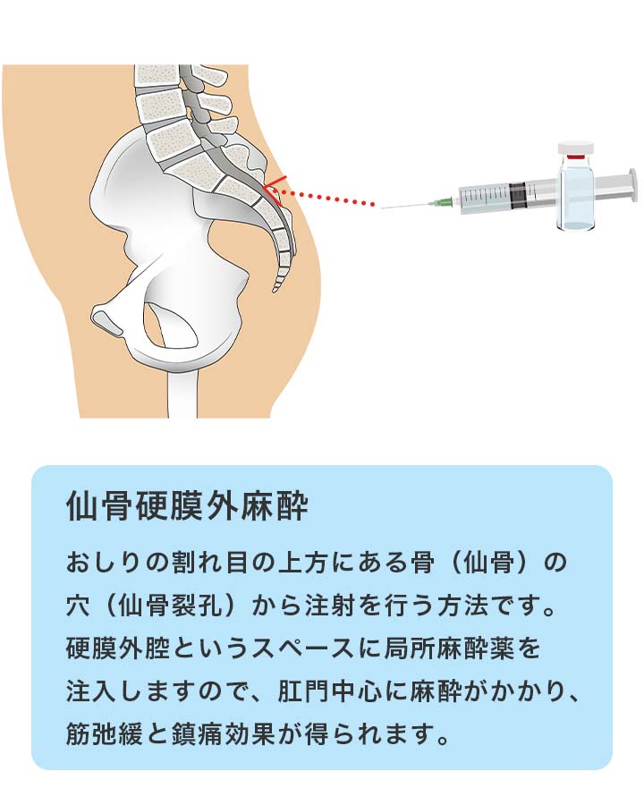 肛門の鎮痛