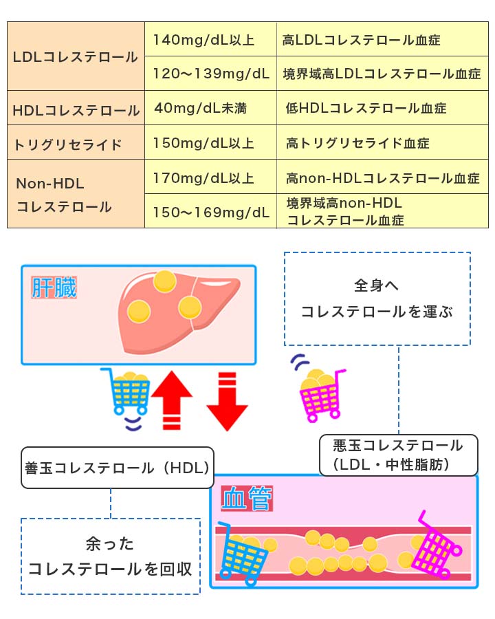 脂質異常症