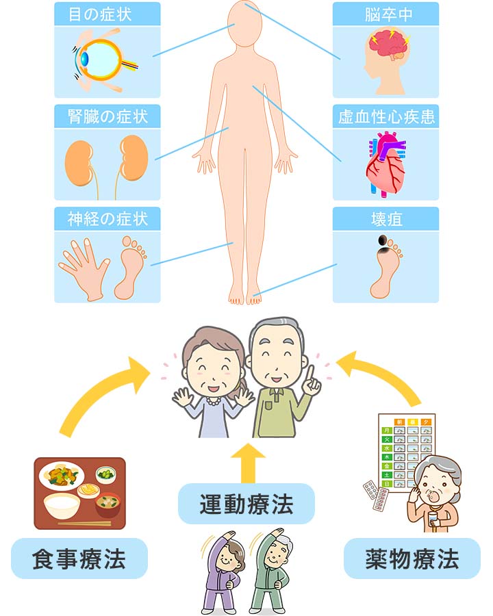 糖尿病