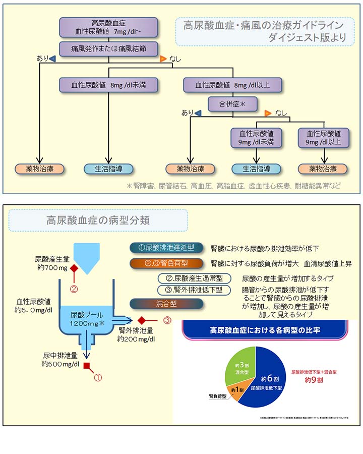 高尿酸血症・痛風